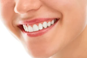 پیوند لثه و استخوان