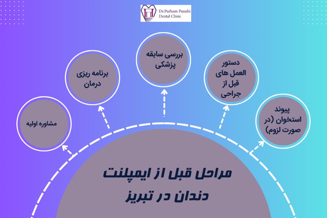 مراحل قبل از ایمپلنت دندان