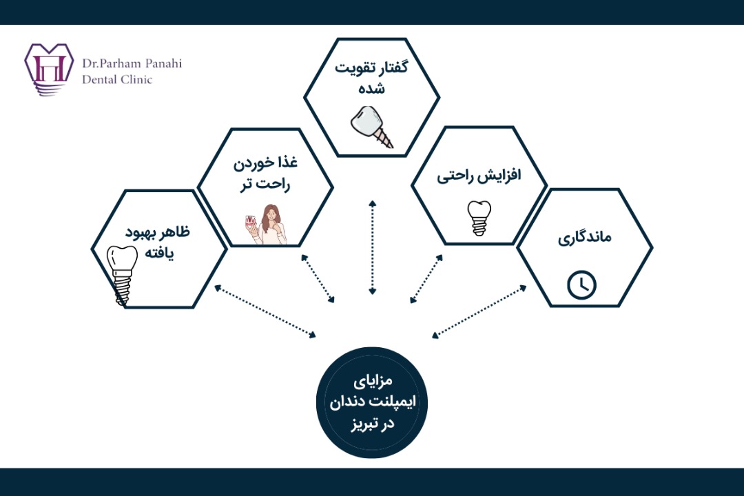 مزایای ایمپلنت دندان در تبریز