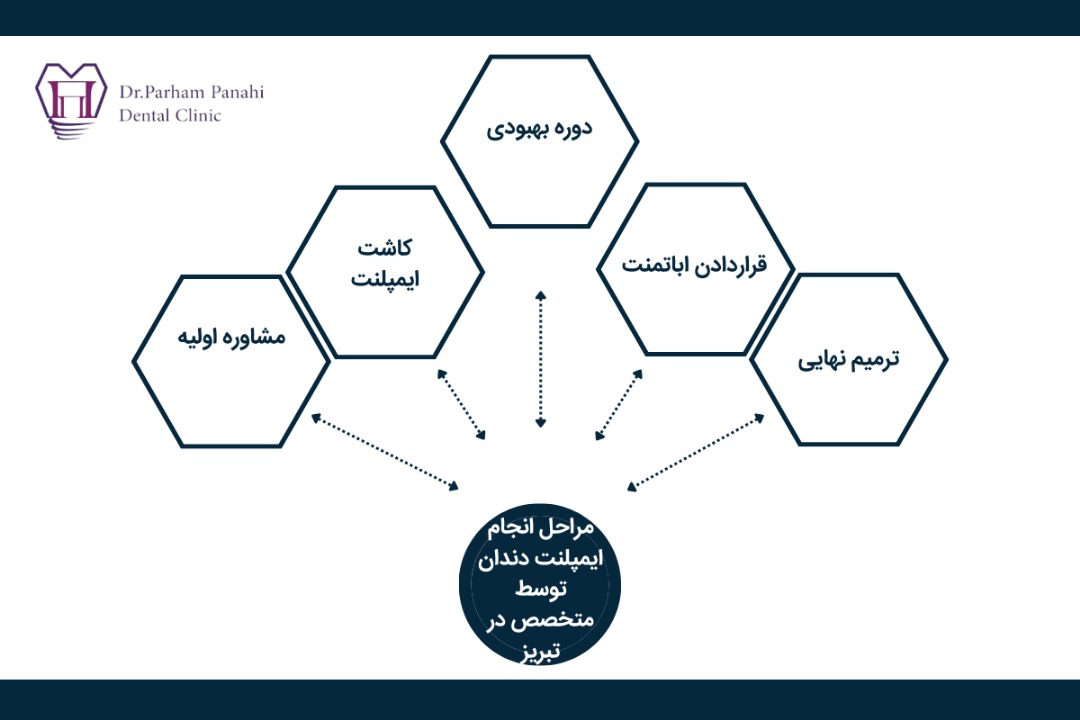 مراحل انجام ایمپلنت دندان توسط متخصص در تبریز