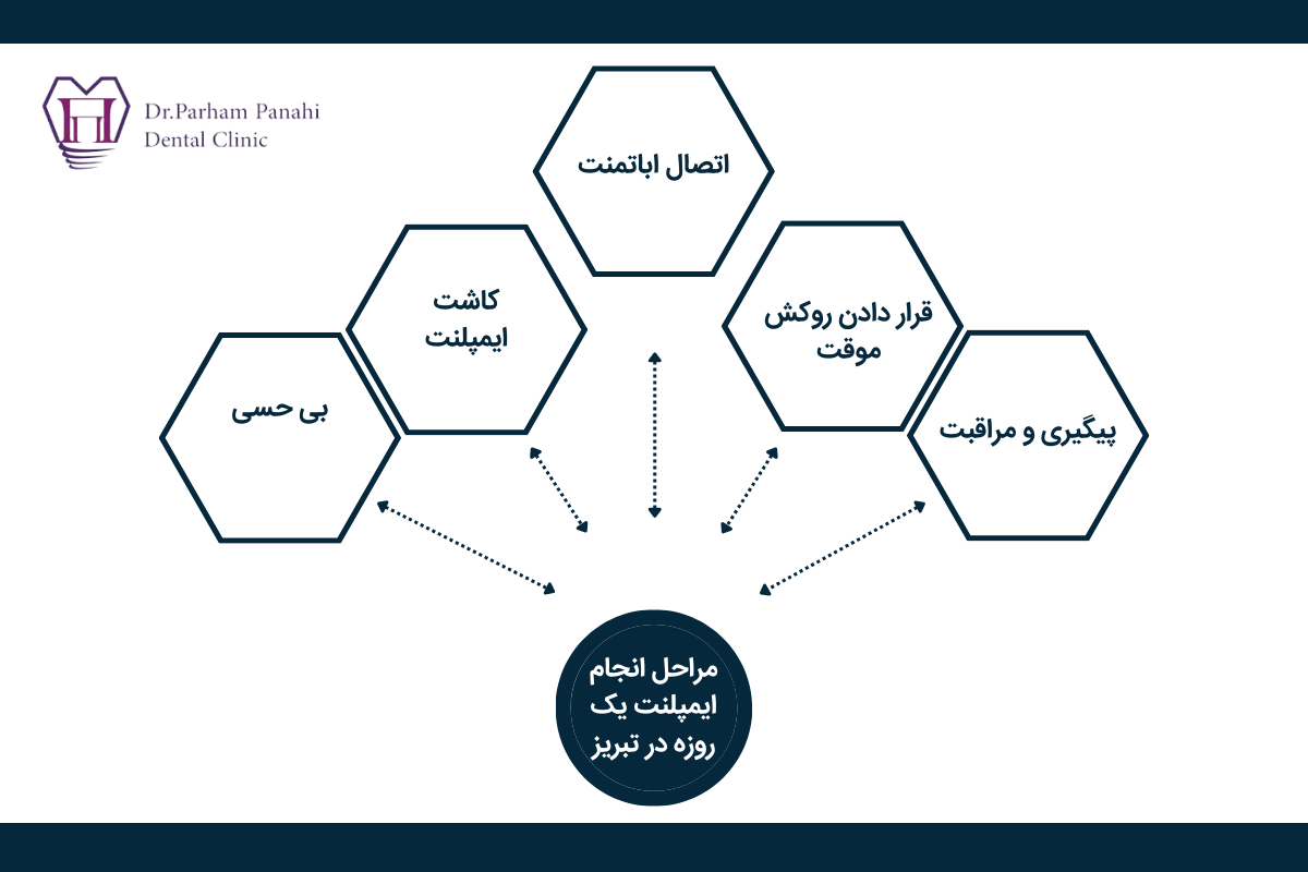 مراحل انجام ایمپلنت یک روزه در تبریز