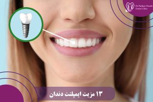 مزایای ایمپلنت دندان