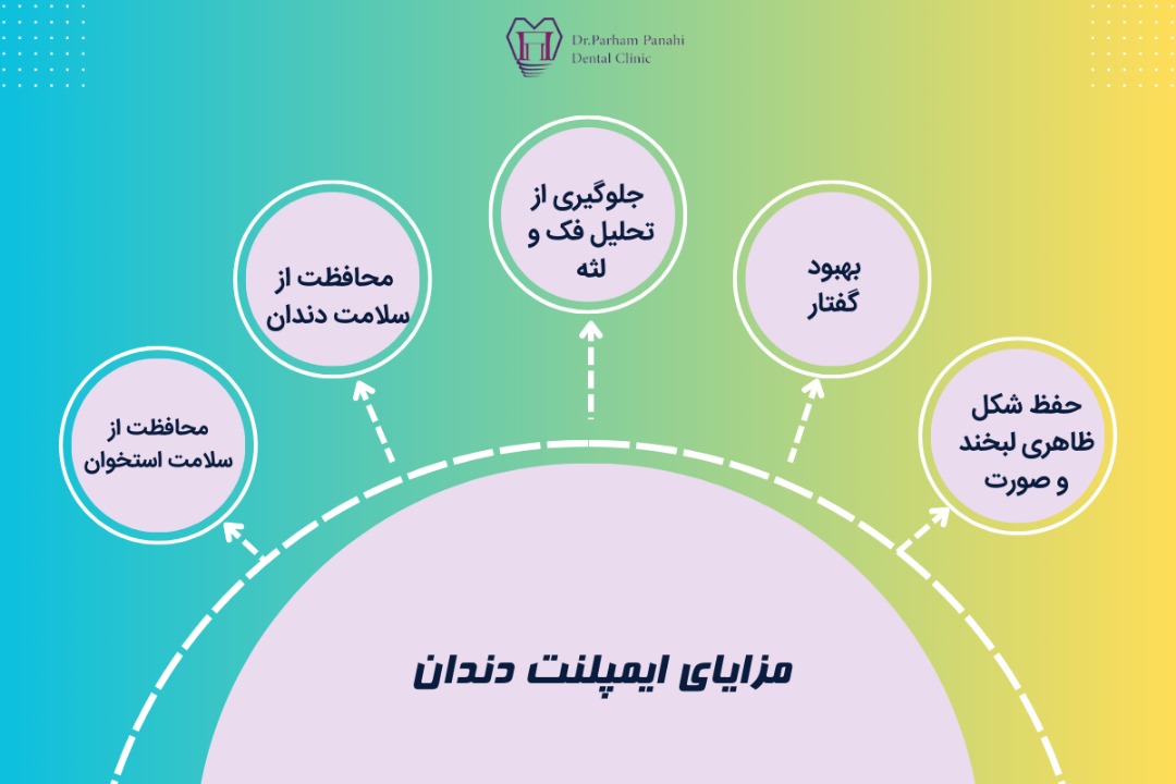 مزایای ایمپلنت دندان