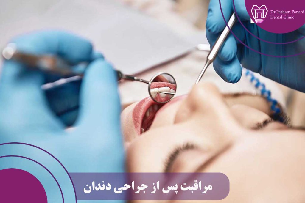 مراقبت پس از جراحی دندان