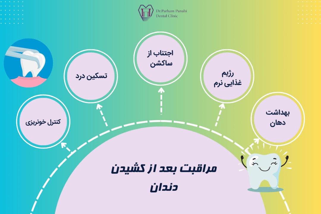 مراقبت بعد از کشیدن دندان