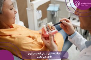ایمپلنت دندان ارزان قیمت در تبریز با بهترین کیفیت