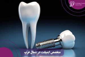 متخصص ایمپلنت در شمال غرب ایران