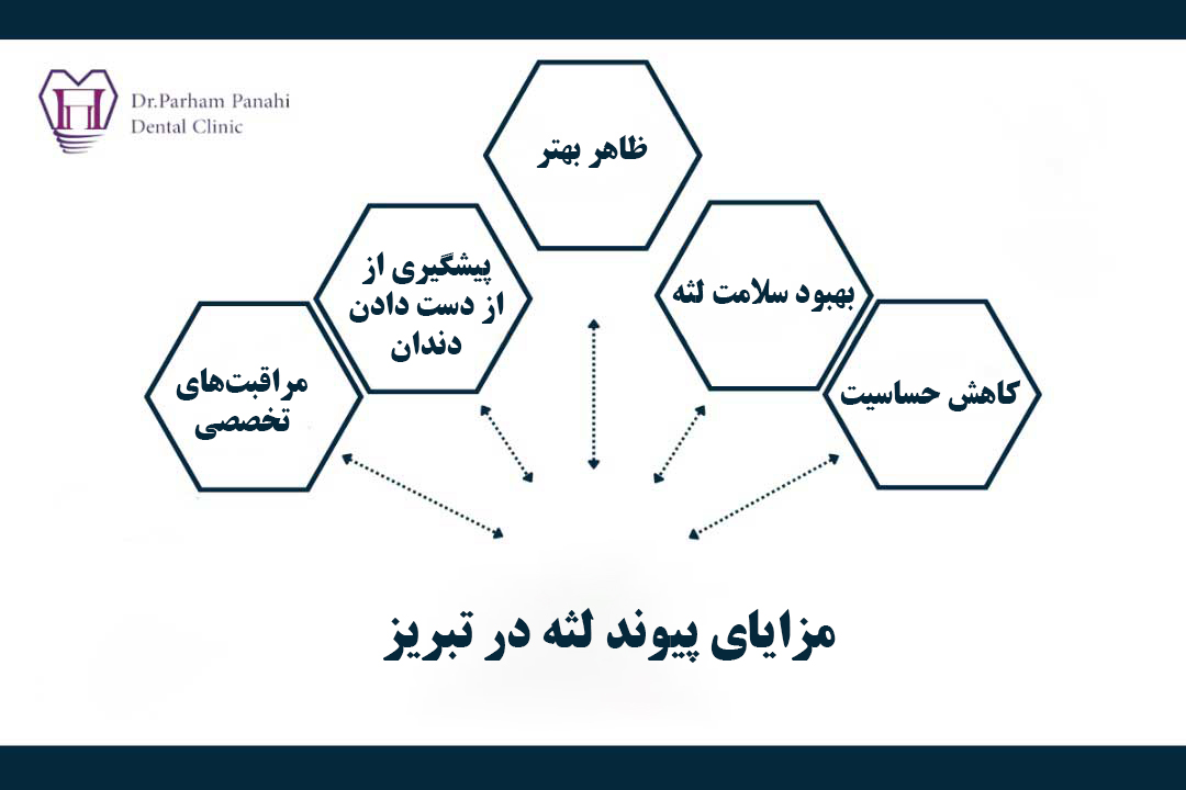مزایای پیوند لثه در تبریز