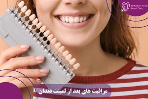 مراقبت های بعد از لمینت دندان