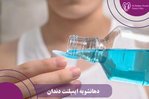 دهانشویه ایمپلنت دندان