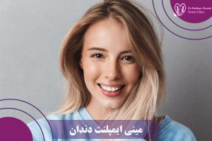 مینی ایمپلنت دندان