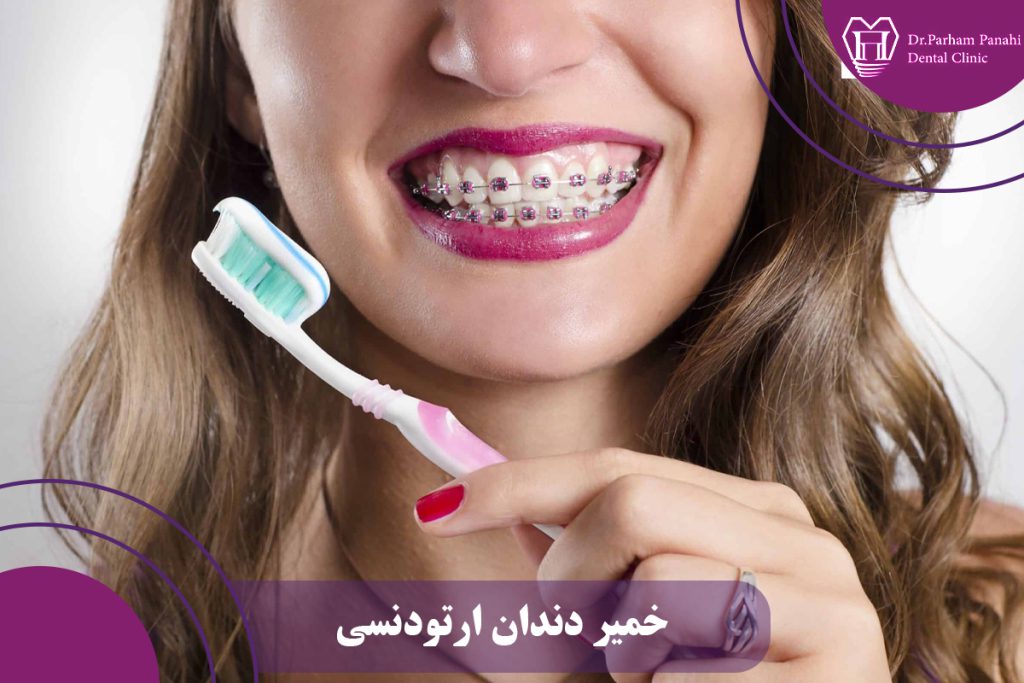 خمیر دندان ارتودنسی