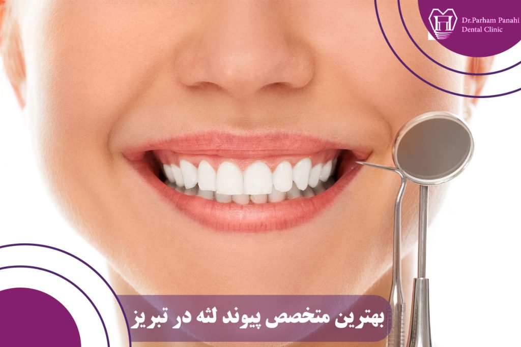 بهترین متخصص پیوند لثه در تبریز