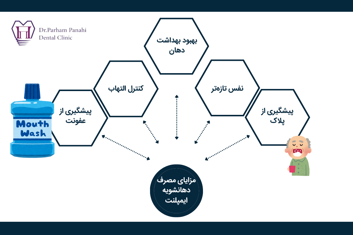 مزایای مصرف دهانشویه ایمپلنت دندان