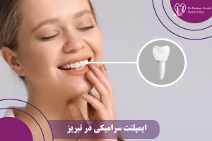 ایمپلنت سرامیکی در تبریز