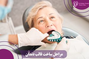 ساخت قالب دندان