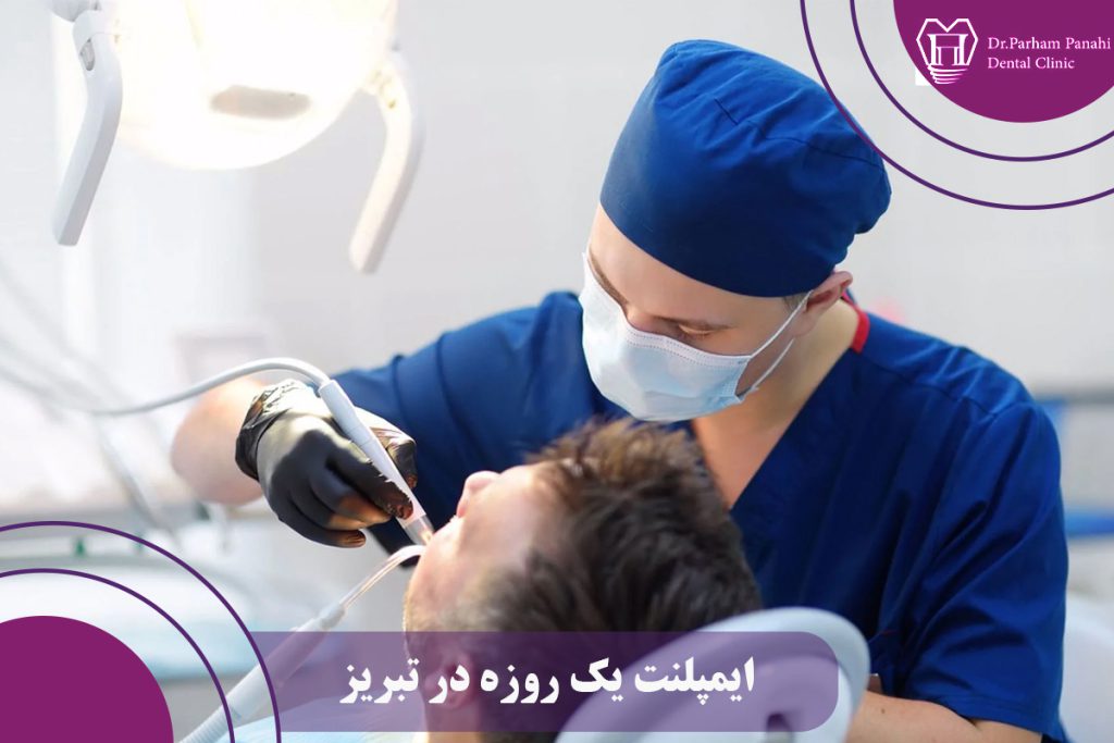 ایمپلنت یک روزه در تبریز