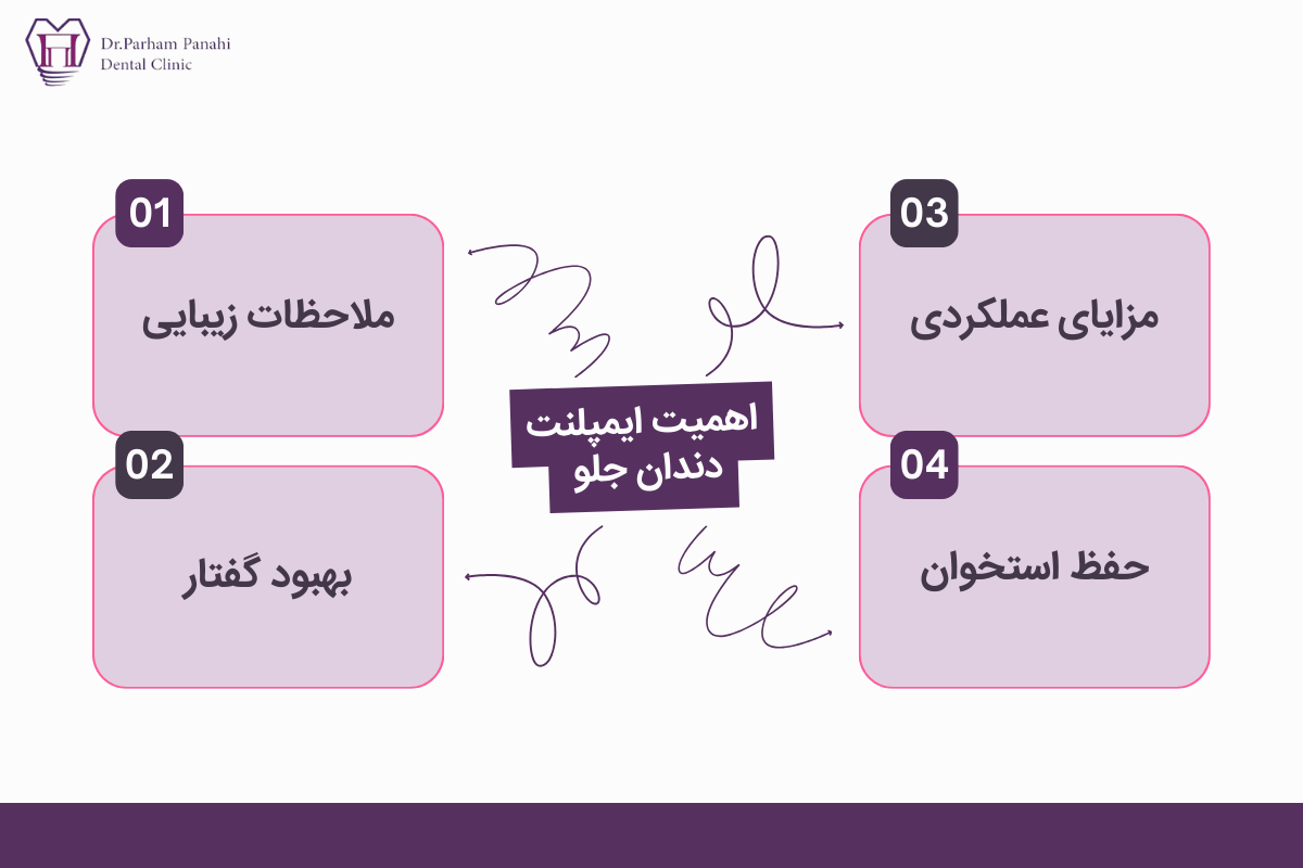 اهمیت ایمپلنت دندان جلو 