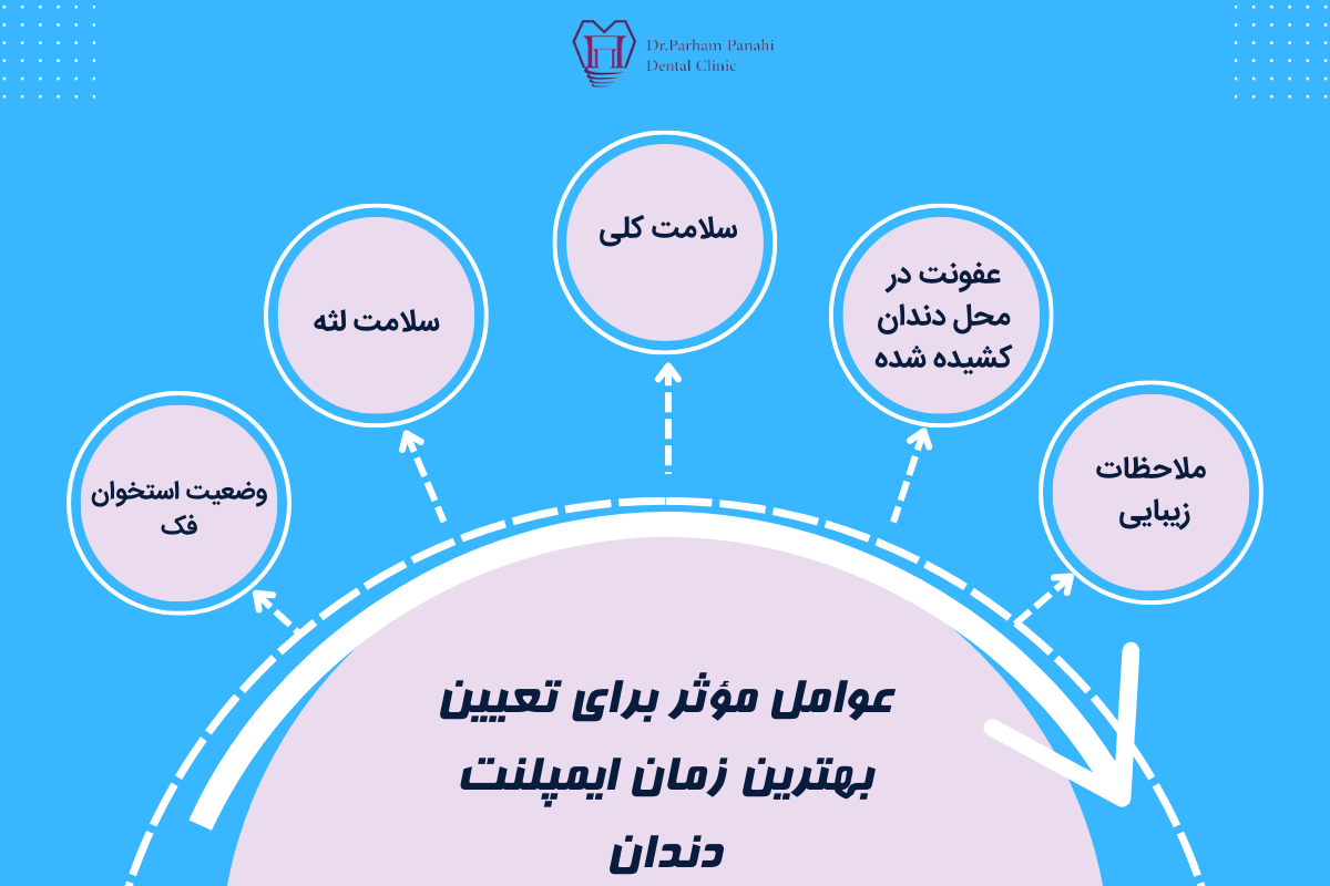 عوامل مؤثر برای تعیین بهترین زمان ایمپلنت دندان