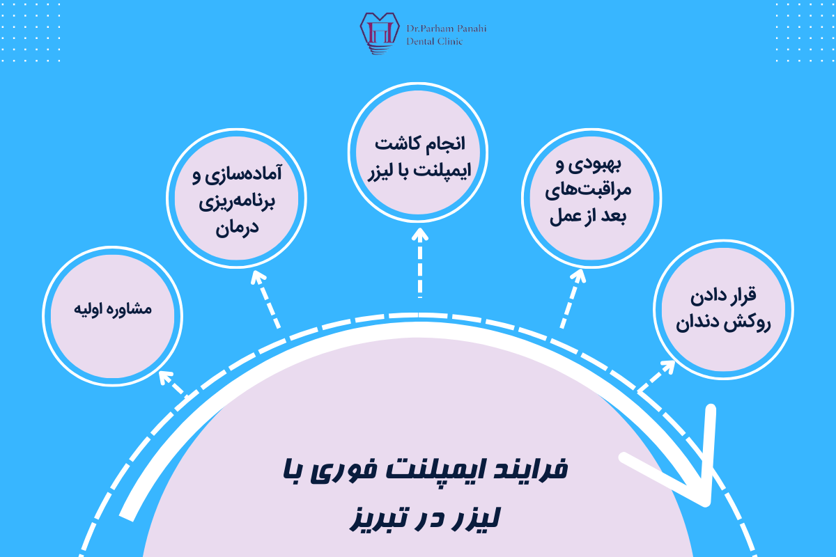 فرایند ایمپلنت فوری با لیزر در تبریز