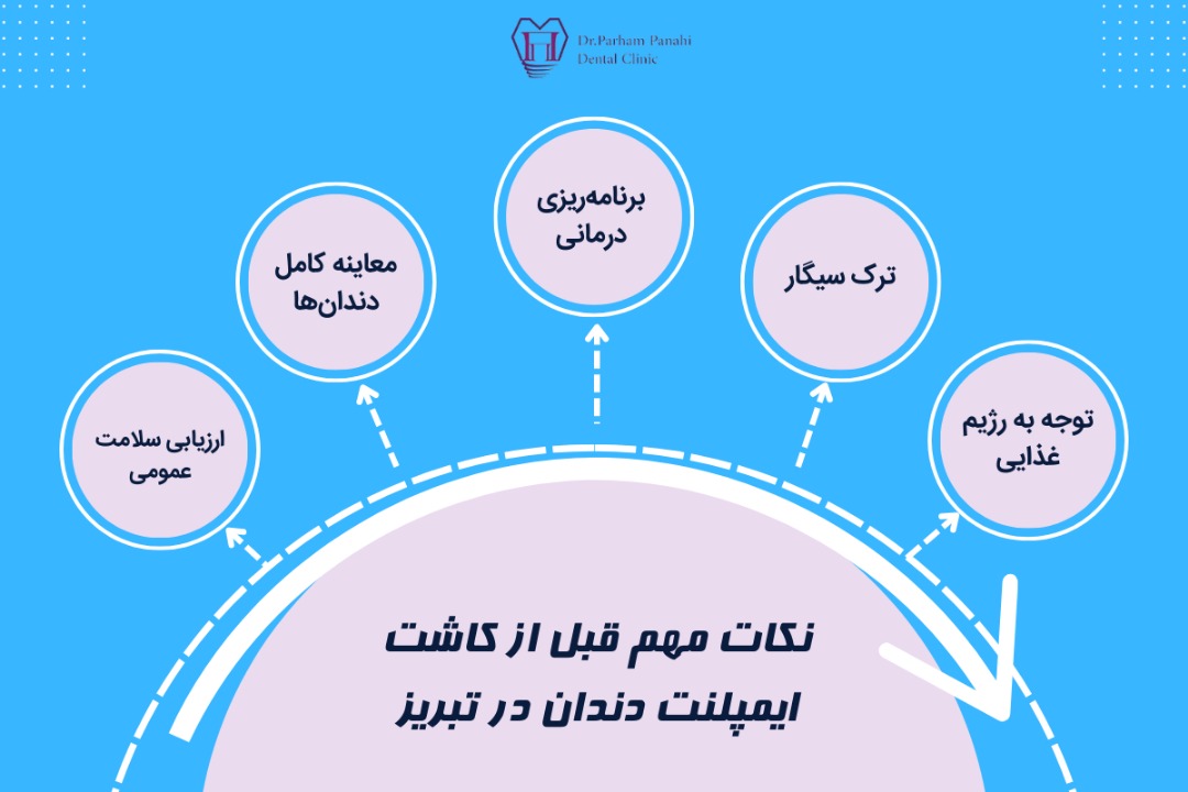 نکات مهم قبل از کاشت ایمپلنت دندان در تبریز