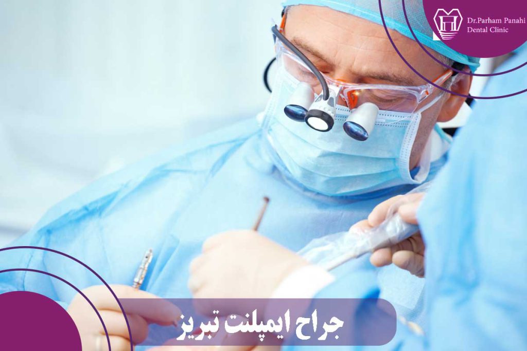 جراح ایمپلنت تبریز
