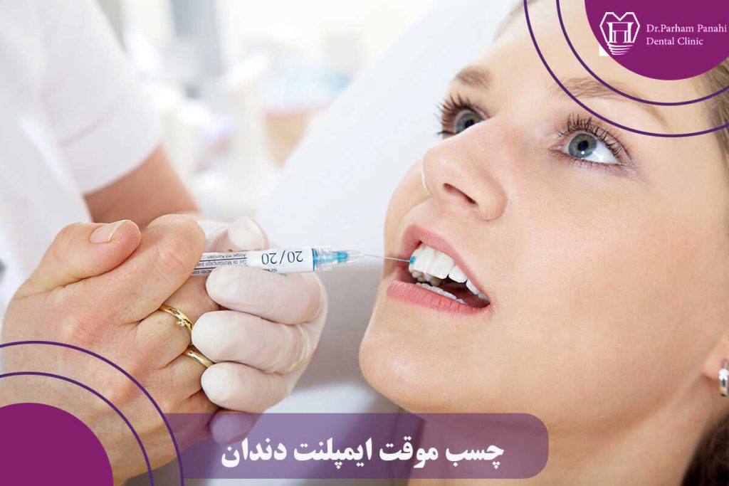 چسب موقت ایمپلنت دندان