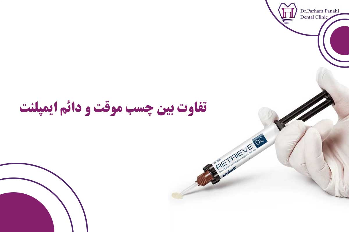 تفاوت بین چسب موقت و دائم ایمپلنت