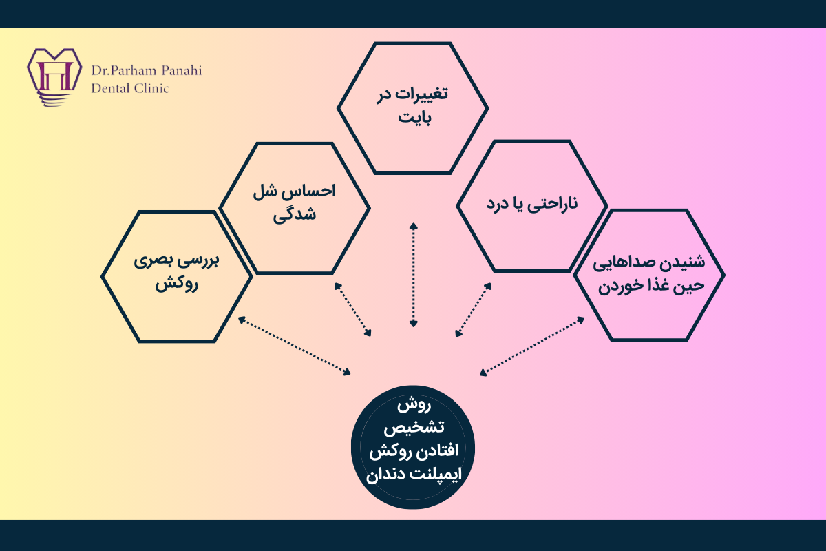 روش تشخیص افتادن روکش ایمپلنت دندان