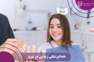 دندانپزشکی زیبایی در تبریز