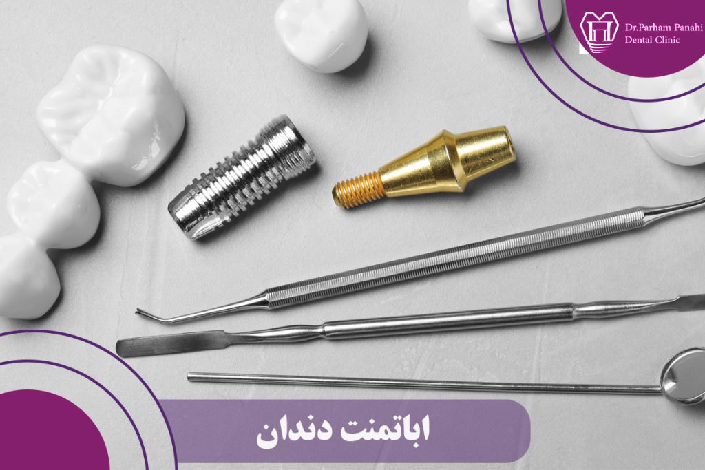 اباتمنت دندان و تأثیر آن بر سلامت دهان