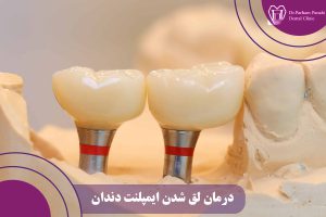 درمان لق شدن ایمپلنت دندان