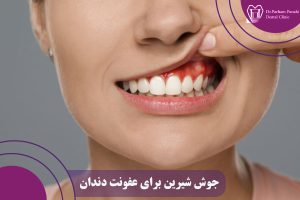 جوش شیرین برای عفونت دندان