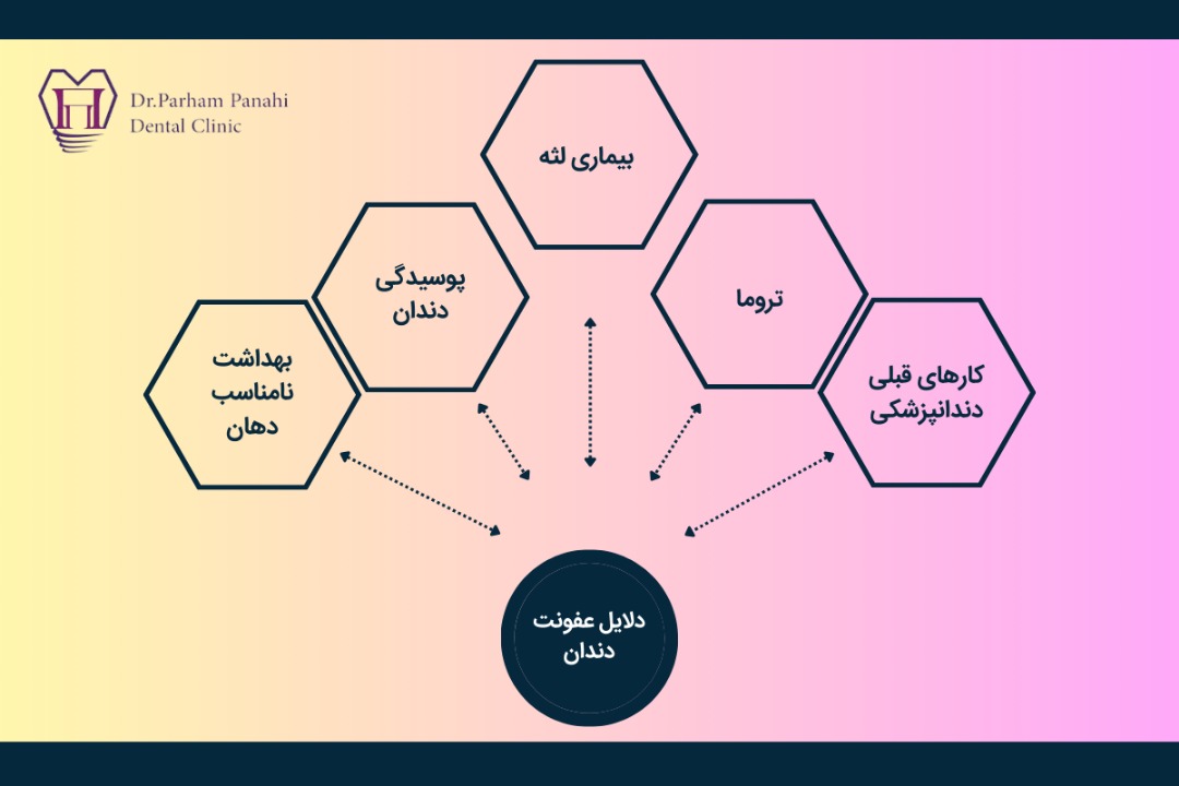 دلایل عفونت دندان