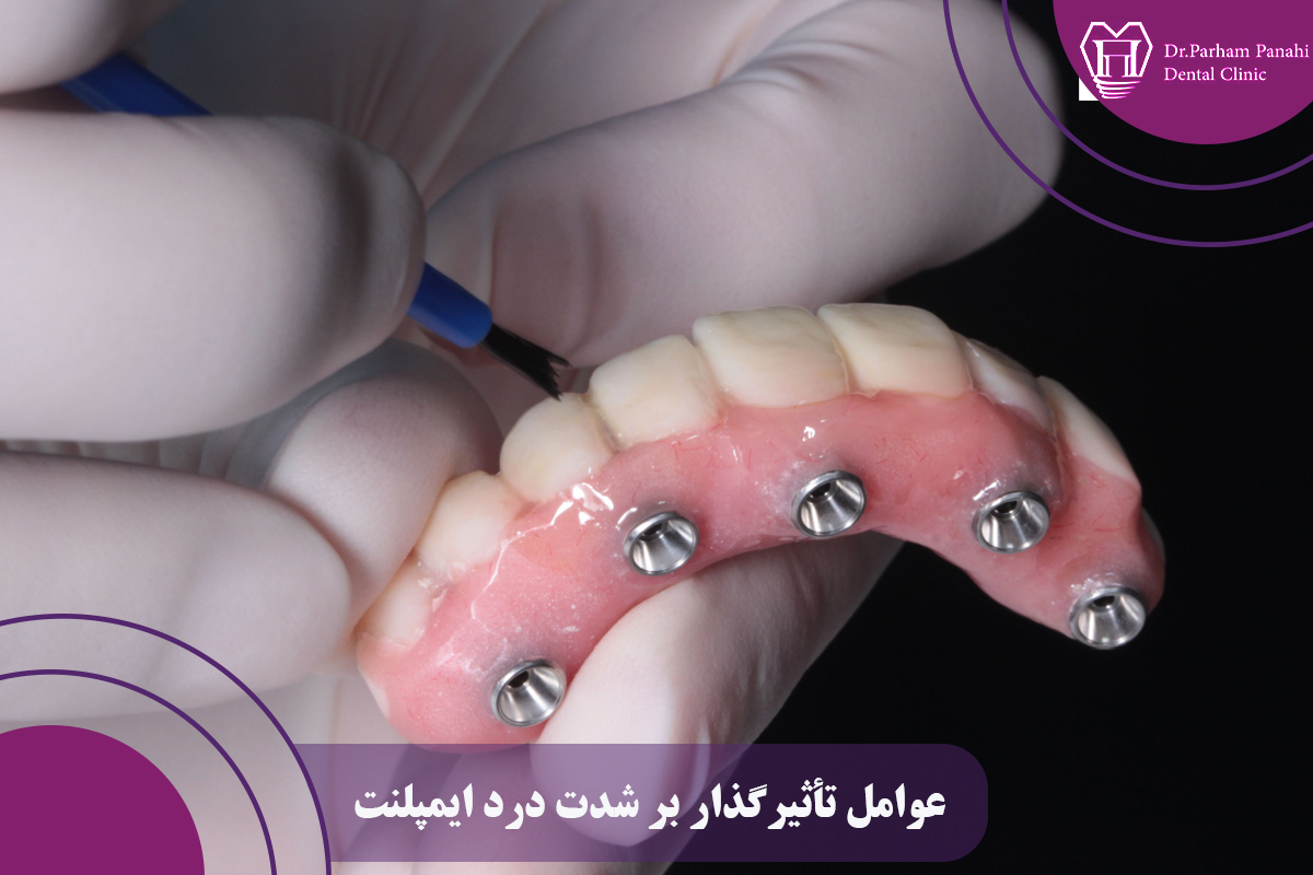 عوامل تأثیرگذار بر شدت درد ایمپلنت