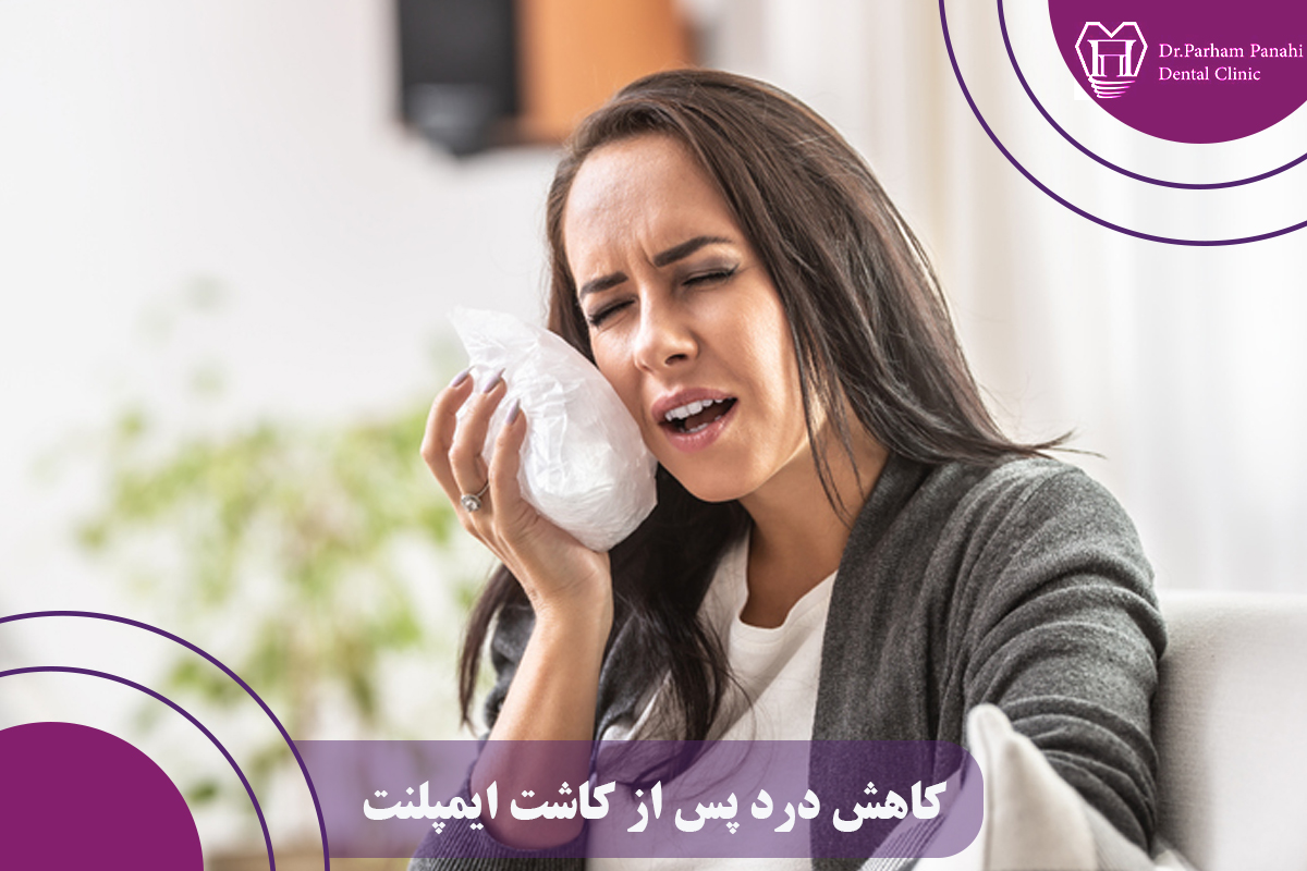کاهش درد پس از کاشت ایمپلنت