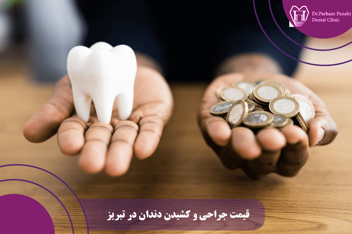 قیمت جراحی و کشیدن دندان در تبریز