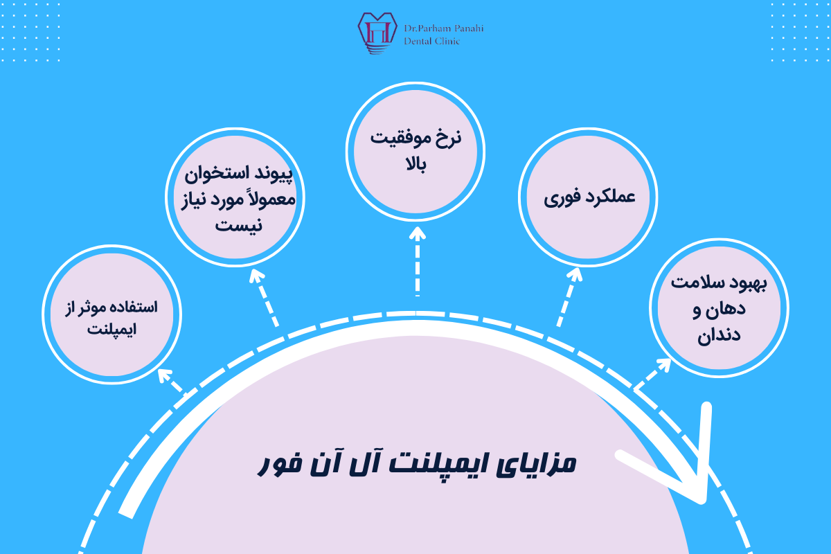 مزایای ایمپلنت آل آن فور