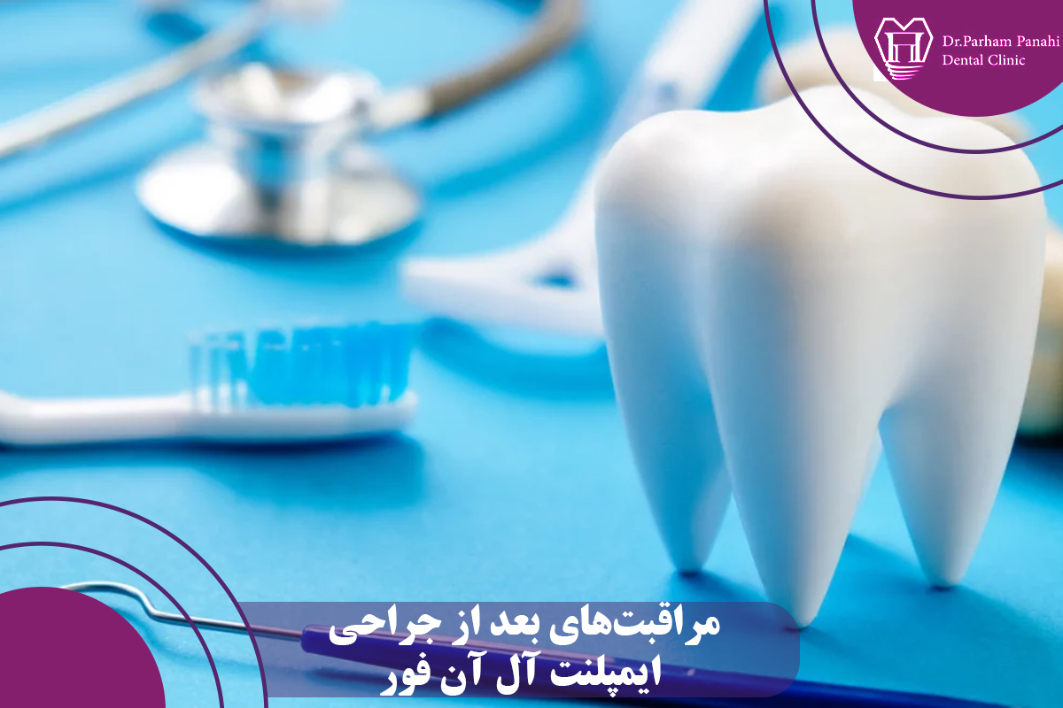 مراقبتهای بعد از جراحی ایمپلنت آل آن فور