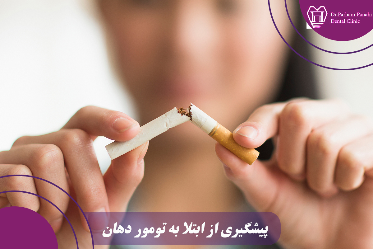 پیشگیری از ابتلا به تومور دهان
