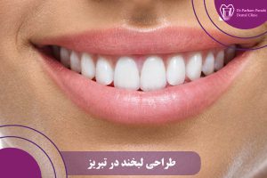 طراحی لبخند در تبریز