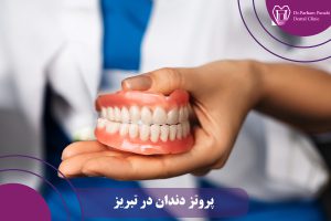 پروتز دندان در تبریز