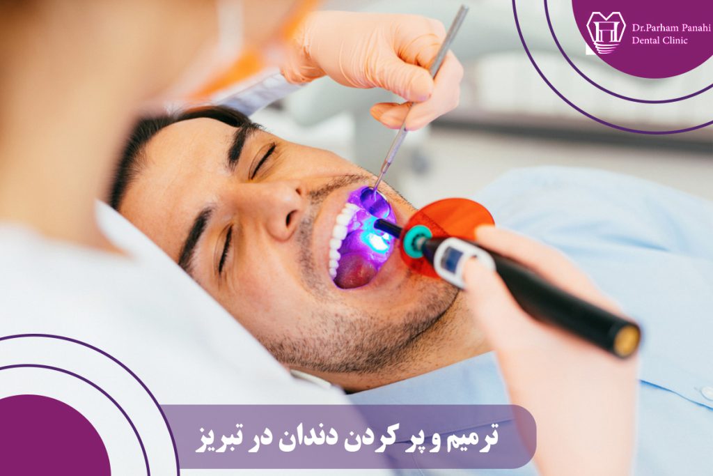 ترمیم و پر کردن دندان در تبریز