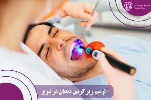 ترمیم و پر کردن دندان در تبریز