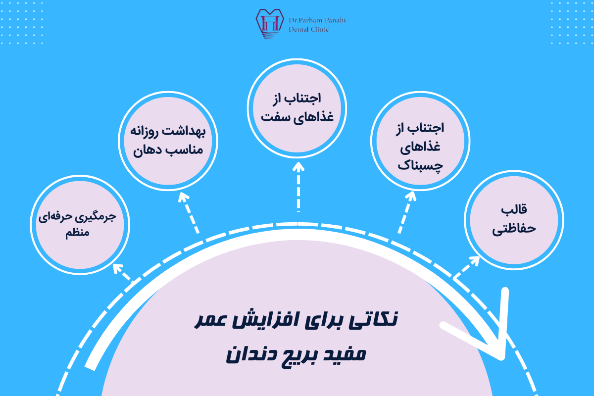 نکاتی برای افزایش عمر مفید بریج دندان