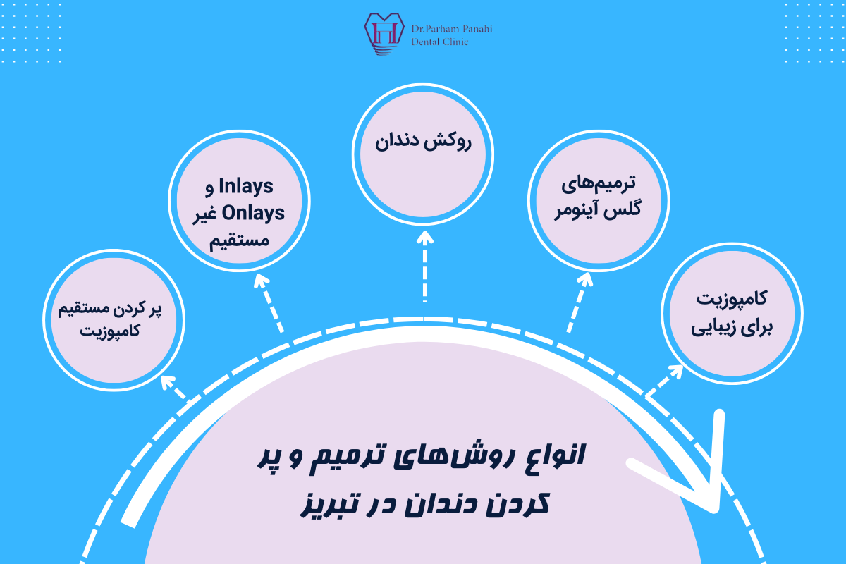 انواع روش‌های ترمیم و پر کردن دندان در تبریز