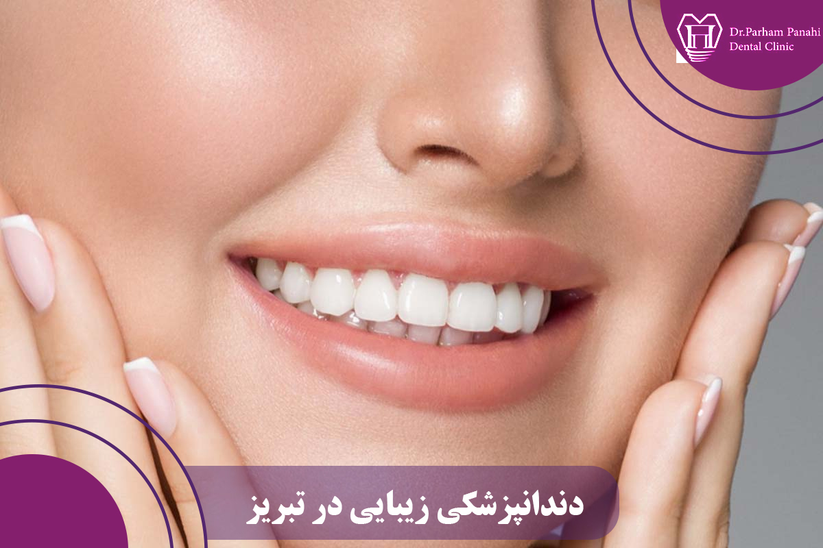 روش‌های انجام دندانپزشکی زیبایی در تبریز