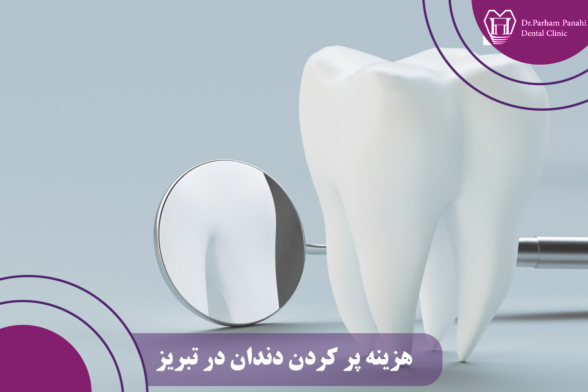 هزینه پر کردن دندان در تبریز 