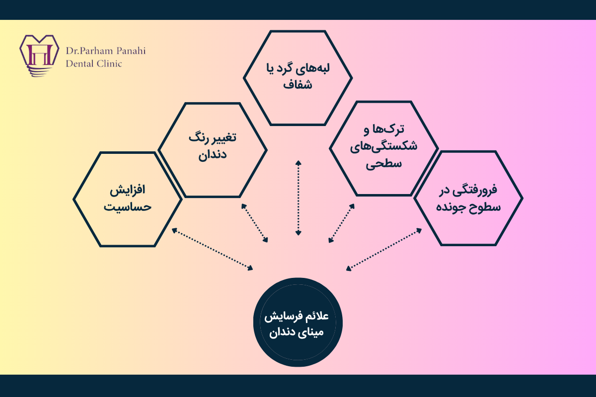 علائم فرسایش مینای دندان