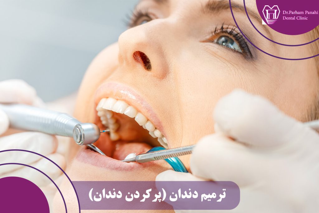 ترمیم دندان
